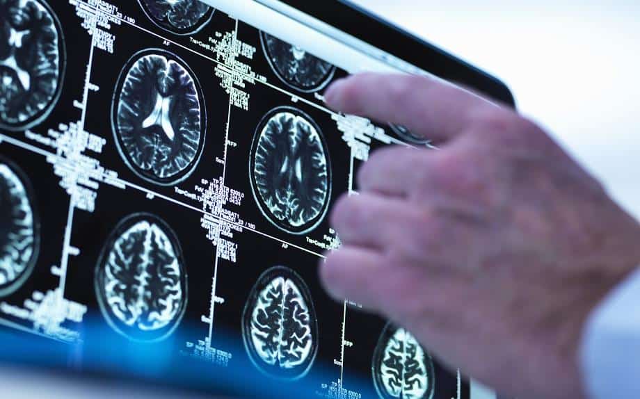 Étude scientifique : Une bonne santé mentale réduit le risque de perte de mémoire à l'âge mûr 1 البحث العلمي