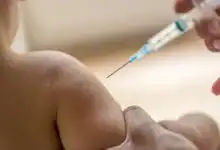 الحصبة