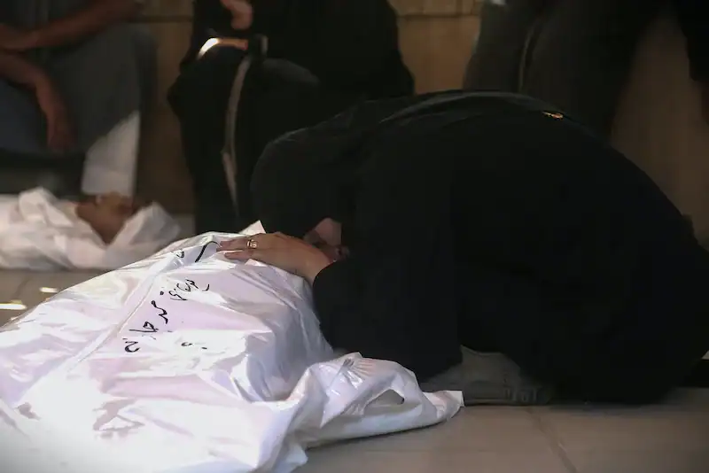 استشهاد 21 طفلاً جراء المجاعة في قطاع غزة