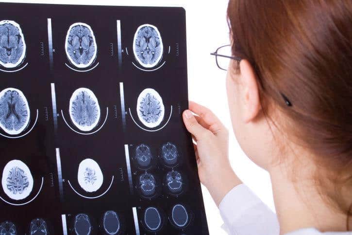 دراسة تكشف أن عقول المصابين بالتوحد منظمة بطريقة مختلفة وليست أقل كفاءة
