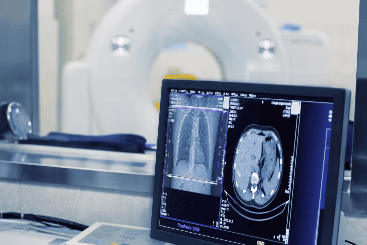 Le ministère de la Santé étend le dépistage par échographie assisté par l'intelligence artificielle à 40 nouveaux centres 1 Le ministère de la Santé étend le dépistage par échographie assisté par l'intelligence artificielle à 40 nouveaux centres