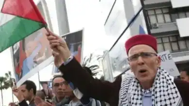 الناشط المغربي سيون أسيدون في العناية المركزة بعد عملية جراحية دقيقة