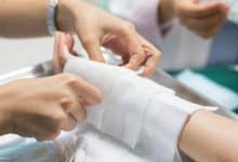 ابتكار سويدي لمادة هلامية تعيد بناء الجلد وتعالج الحروق