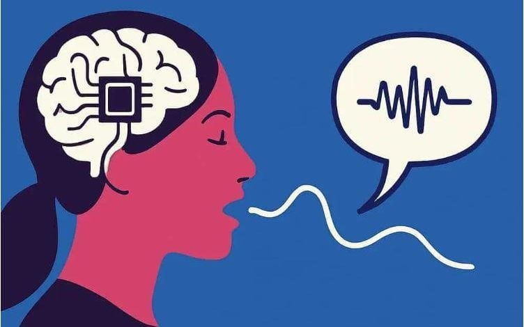 تطوير أول شريحة دماغية لتحويل الأفكار إلى كلمات منطوقة