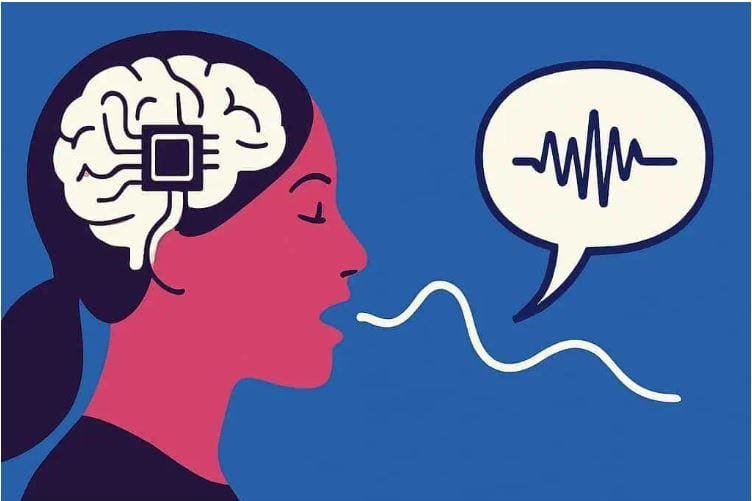 Mise au point de la première puce cérébrale permettant de transformer les pensées en paroles 1 تطوير أول شريحة دماغية لتحويل الأفكار إلى كلمات منطوقة