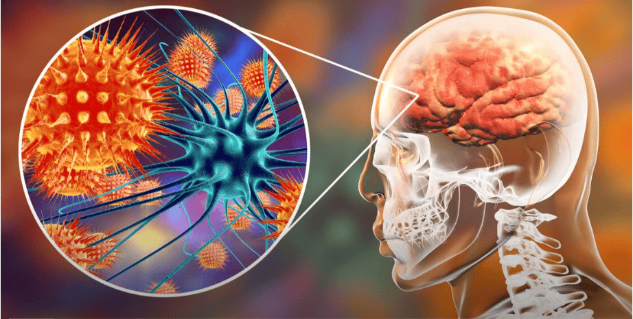 التهاب السحايا: داء خطير يتطلب تدخلاً طبياً فورياً