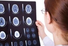 دراسة تكشف أن عقول المصابين بالتوحد منظمة بطريقة مختلفة وليست أقل كفاءة
