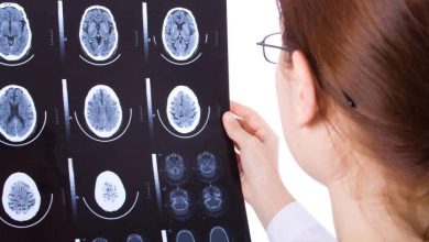 دراسة تكشف أن عقول المصابين بالتوحد منظمة بطريقة مختلفة وليست أقل كفاءة