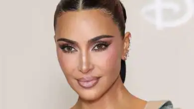 إصابة كيم كارداشيان بتمدد دموي في الدماغ تثير القلق والتفاعل 11 إصابة كيم كارداشيان بتمدد دموي في الدماغ تثير القلق والتفاعل