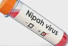 الصحة العالمية تكشف حقيقة انتشار فيروس نيباه خارج الهند