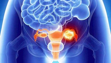 دواء تجريبي يضاعف تقريبًا فرص نجاة مريضات سرطان المبيض