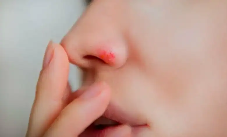 الأنف يحتفظ بذاكرة مناعية ضد الفيروسات ويواجهها عند عودتها