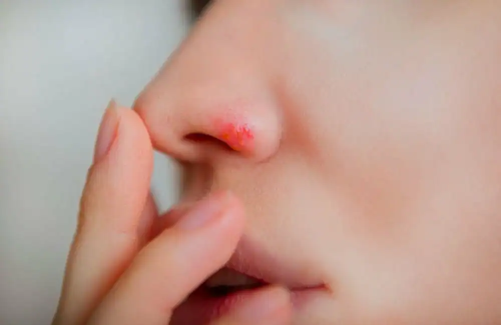 Le nez garde une mémoire immunitaire des virus et les combat lorsqu'ils reviennent. 1 الأنف يحتفظ بذاكرة مناعية ضد الفيروسات ويواجهها عند عودتها