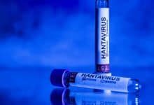 L'hantavirus approche des Pays-Bas L'Organisation mondiale de la santé (OMS) clarifie la menace de l'hantavirus 20 هونديوس تقترب من هولندا.. ومنظمة الصحة العالمية توضح حقيقة خطر فيروس هانتا